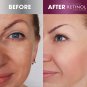 RETINOL Anti-Wrinkle Facial Serum