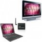 Wireless Dental Camera - AV or USB Connection