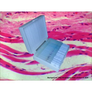 25 PCS Professionally Prepared Slides Set