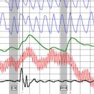 Polygraph Test