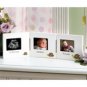 Sonogram & 1st Year Triple Frames in Turtle