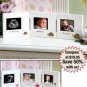 Sonogram & 1st Year Triple Frames in Turtle