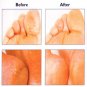 Nichidi Cracked Heels Cream For Recover Rough Hard Skin Cracked Heels