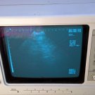 Fukuda Denshi FFSonic 3.5MHz UF-4500 Portable Ultrasound system w/ 3.5MHz Probe
