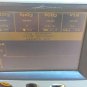 Respironics NICO2 Non-Invasive Cardiac Output Patient Monitor CO2 O2 NICO 2 7600