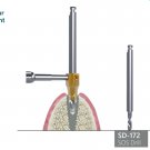Dental Full SOS Kit Removes stuck/broken/worn implant or screw *FREE* SHIPPING Dental Full SOS Kit Removes stuck/broken/worn implant or screw *FREE* SHIPPING