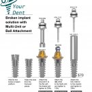 Broken Implant Solution With Abutment