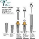 Broken Implant Solution With MultI-Unit