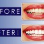 Twilight Teeth