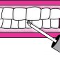 Twilight Teeth