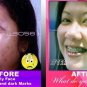Beaucheinternational