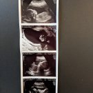 Prank Pregnancy Fake Customized 2D Ultrasound, 4 Photo Strip  REAL US PAPER