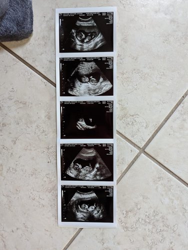 Prank Pregnancy Fake Customized 2D Ultrasound, 5 Photo Strip  REAL US PAPER