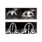 Nasal Dilator / Anti-Snoring Device for Use in the Nose