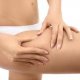 Cellulite