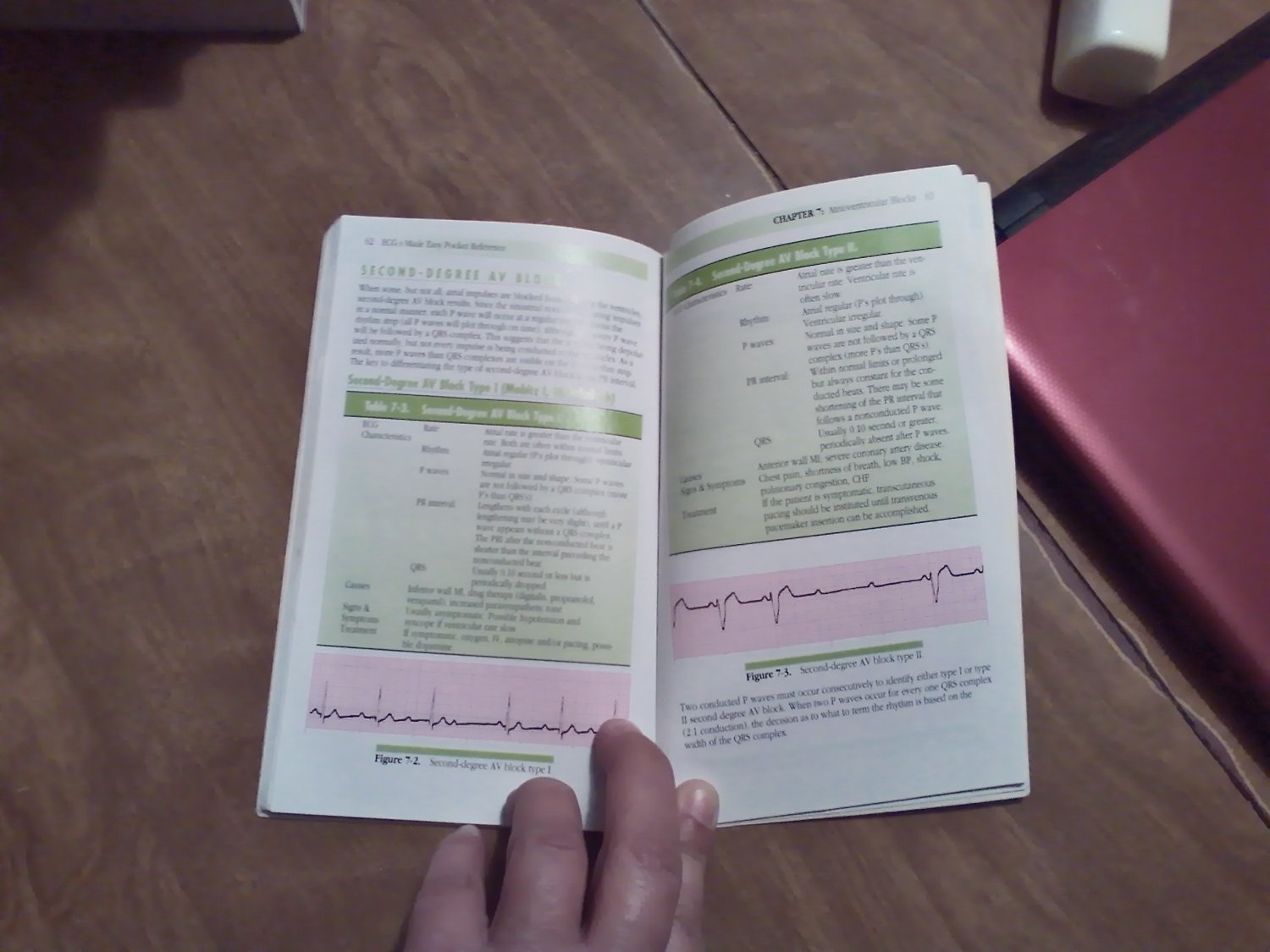 ECGs Made Easy Pocket Reference By Barbara Aehlert (1995) (WCC4) ECG ...