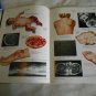 Clinical Symposia Common Soft Tissue Tumors (1990) (GR1r3) Volume 42 Number 1 PB