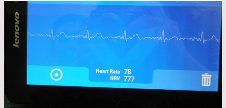 BMD101 Micro Wireless ECG Electrocardio Sensor Module w/Bluetooth Transmission
