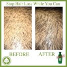BSC Falless Hair Reviving Shampoo for Hair Loss
