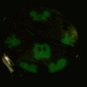 Brand-New Disney Glow in Dark Hands/Pants/Gloves/Face Mickey Mouse Watch! HTF!