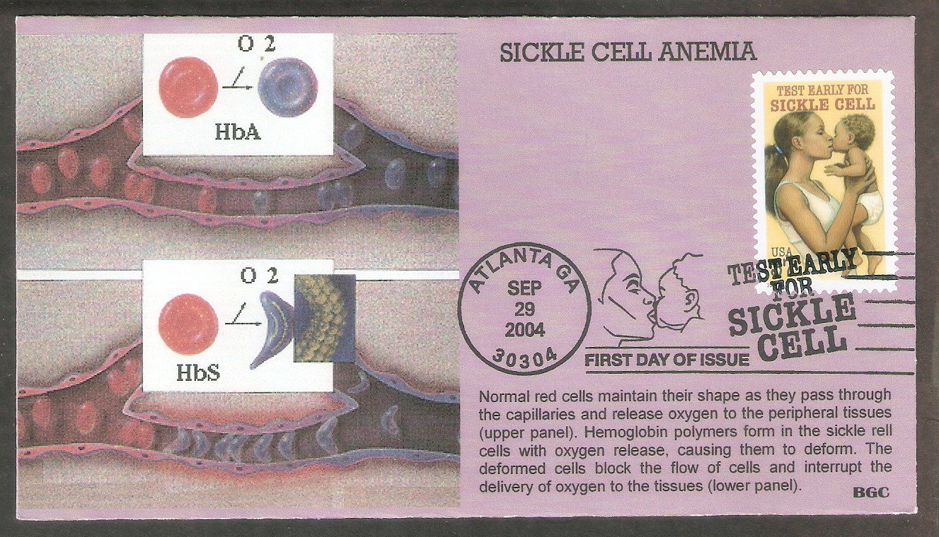 Test Early For Sickle Cell Anemia, BGC, First Issue USA