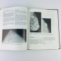 Mammographic Imaging: A Practical Guide Hardcover 1st Edition 1992 Book