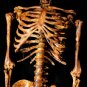 Life Size Aged Bucky Skeleton Corpse Halloween Prop