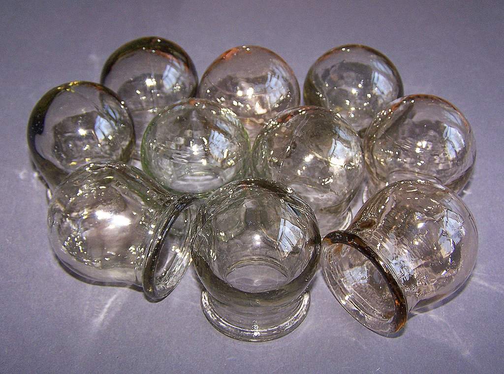 CHINESE MASSAGE THERAPY. SET OF 10 GLASS MASSAGE CUPS. CUPPING JARS.