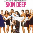 Skin Deep - DVD - 1989 - Blake Edwards - John Ritter, Vincent Gardenia MOD Skin Deep - DVD - 1989 - Blake Edwards - John Ritter, Vincent Gardenia MOD