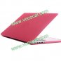 Frosted Crystal Case Cover for Macbook Pro A1286 MC975 MC976 15.4" Retina Pink