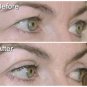 Eye Magic Eyelid Tape Strips