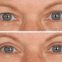 Eye Magic Eyelid Tape Strips