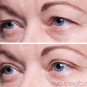 Eye Magic Eyelid Tape Strips