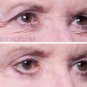Eye Magic Eyelid Tape Strips