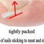 Ingrown Toenail Correction Ultra-thin Nail Treatment Elastic Patch Sticker Straighteni