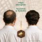 Tio Nacho Mexican Herbs Shampoo, Strengthening, Anti Hair Loss & Anti Breakage with Royal Jelly