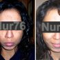 (Free Gift)Nur76&Acirc;&reg; Skin Lightening Serum and Cream for Face Only (~90 Days Money Back Gaurantee~)