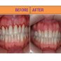 KNARF DENTAL HEALING THERAPY - 60ml