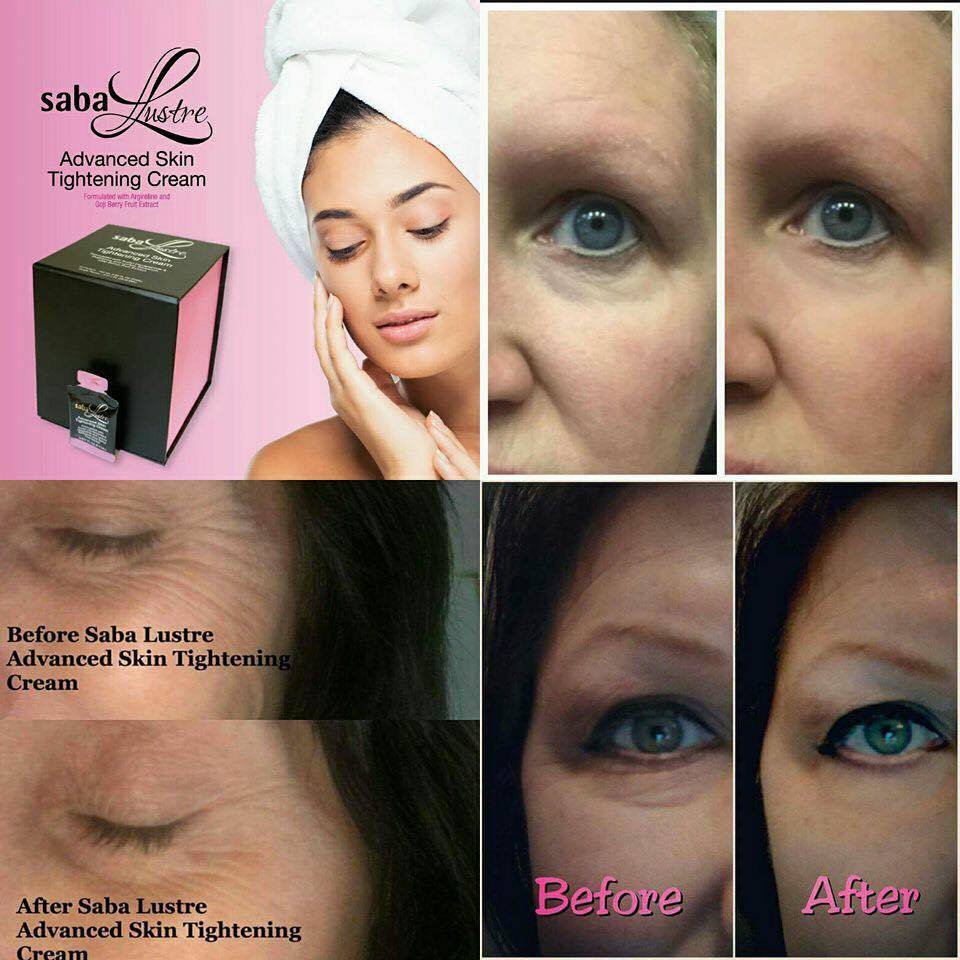 eye skin tightening cream