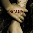 SCARS