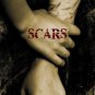 SCARS