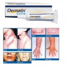 DERMATIX ULTRA - ADVANCED SCAR GEL REDUCTION TREATMENT SURGERY KELOID BURN WOUNDS SCAR REDUCTION 7g