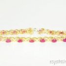 6.68 CTW Ruby & Diamond Tennis Bracelet 14K Yellow Gold
