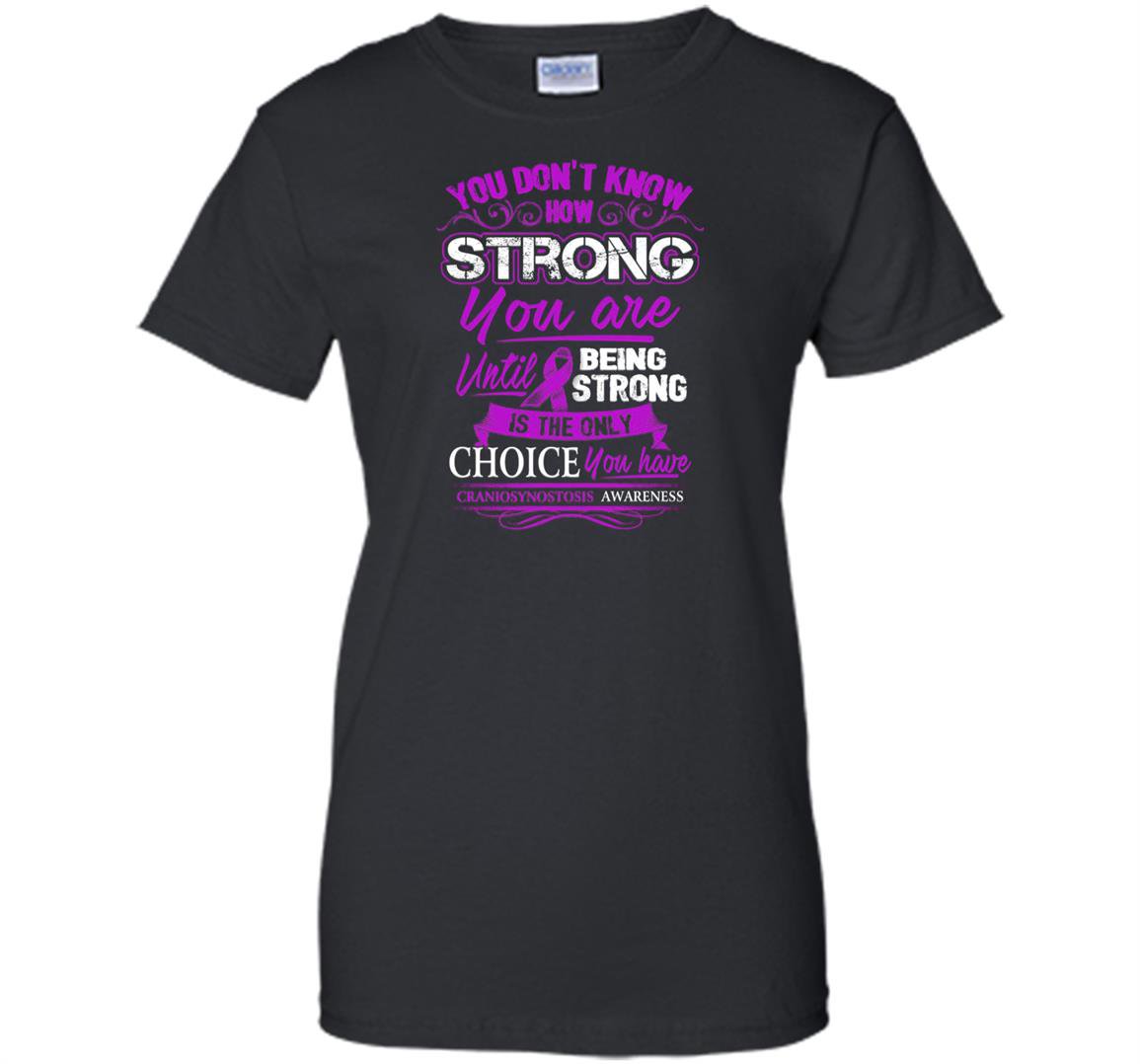 Craniosynostosis being strong is the only choice Women