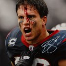 Brian Cushing Autographed 16x20 Bloody Face Color *White Photo- JSA W Auth