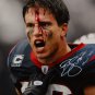 Brian Cushing Autographed 16x20 Bloody Face Color *White Photo- JSA W Auth