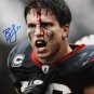 Brian Cushing Autographed 8x10 Bloody Face *Blue Photo- JSA W Authenticated