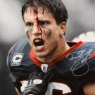Brian Cushing Autographed 16x20 Bloody Face Color *Silver Photo- JSA W Auth