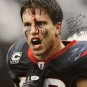 Brian Cushing Autographed 20x24 Bloody Face Beast (Blk) Canvas- JSA W Auth