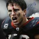 Brian Cushing Autographed 16x20 Bloody Face Color *Blue Photo- JSA W Auth